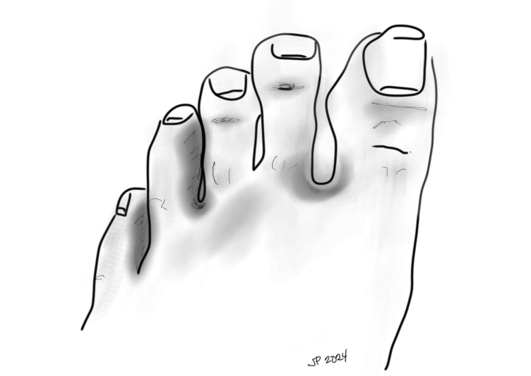 a self-portrait sketch of my toes including my lucky toenails